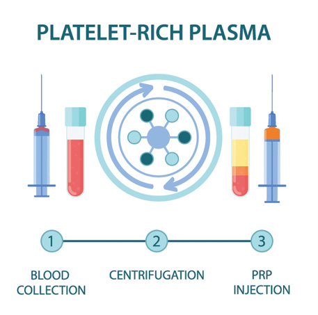 PRP Injections Chicago, AC Joint Glenview